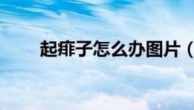 起痱子怎么办图片（起痱子怎么办）