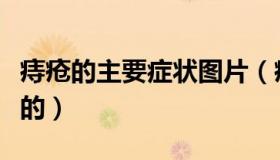 痔疮的主要症状图片（痔疮的症状图片是哪样的）