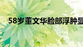 58岁董文华脸部浮肿显苍老（58租房子）
