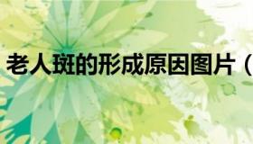 老人斑的形成原因图片（老人斑的形成原因）