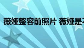 薇娅整容前照片 薇娅是不是整过容脸怪怪的