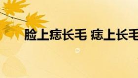 脸上痣长毛 痣上长毛是好事还是坏事