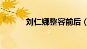 刘仁娜整容前后（刘仁娜的脸）