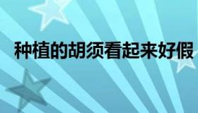 种植的胡须看起来好假（种植胡须效果图）