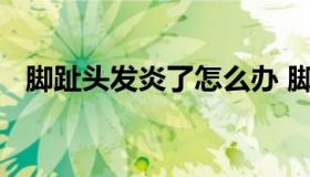 脚趾头发炎了怎么办 脚趾头发炎痛怎么办